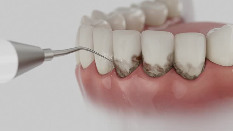 Reliable Dental Implants contractor in Kenton, OH by Smile Center Dentistry